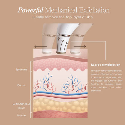 AeroAcne | Removal